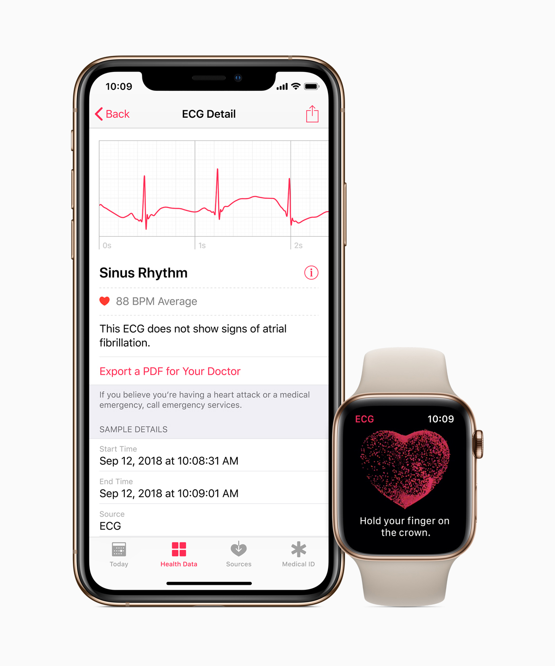 Megjelent az ECG app és a szabálytalan szívritmus értesítés az Apple Watch-ra - Apple Hírek