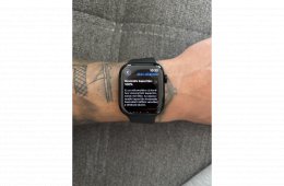 Apple Watch Series 11 46 mm 2027.08-ig Apple garancia
