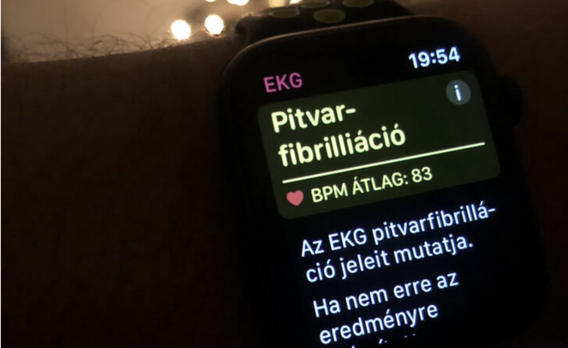 Magyar életet mentett az Apple Watch